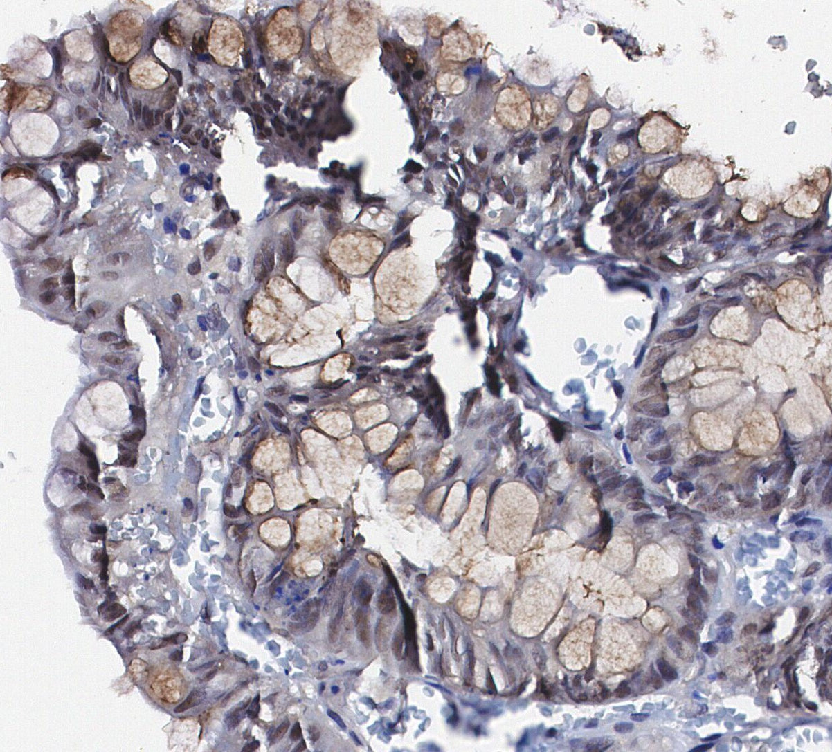 Ubiquitin Antibody