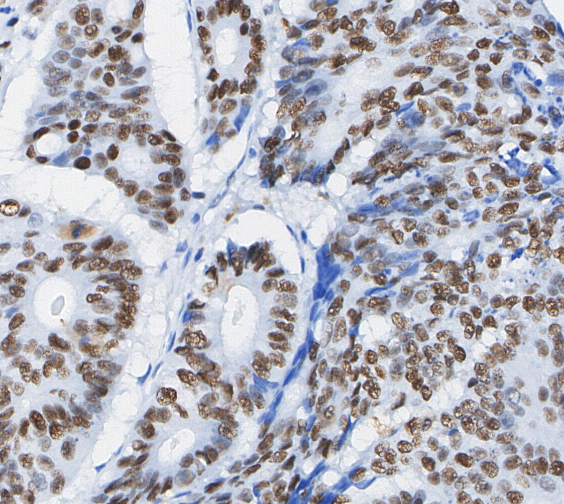 c-Jun Antibody