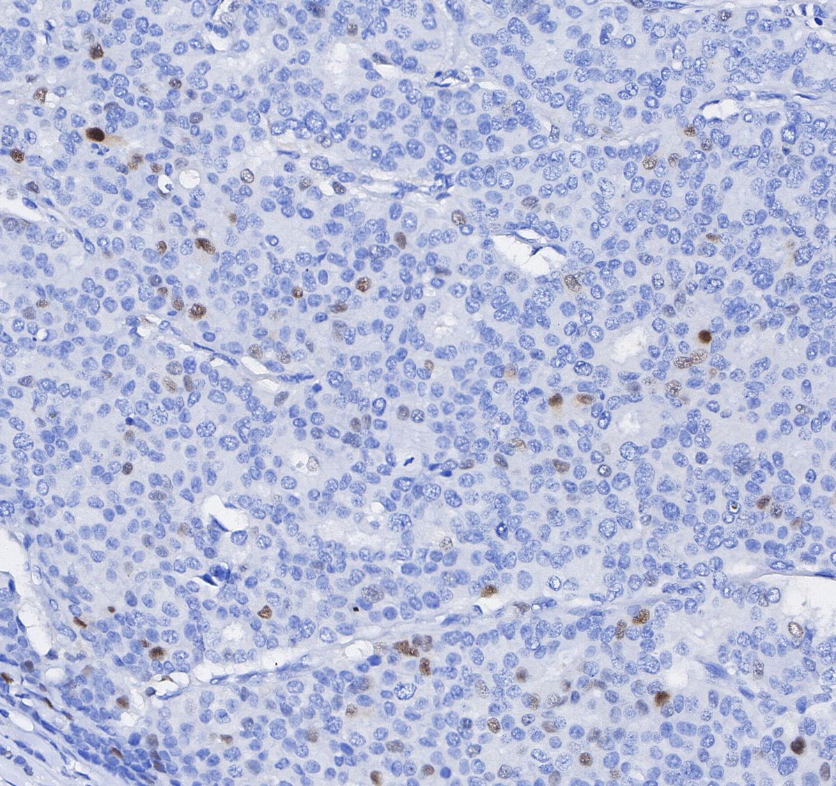 p21 Waf1/Cip1 Antibody