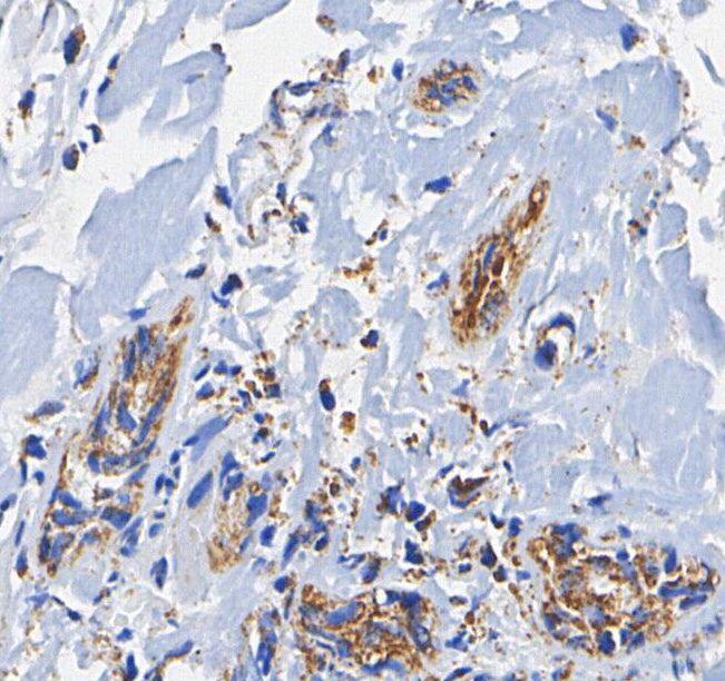 PDI Antibody