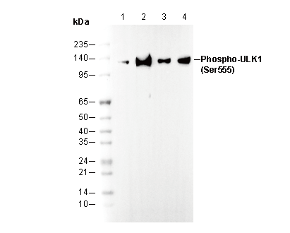 Phospho-ULK1 (Ser555) Antibody