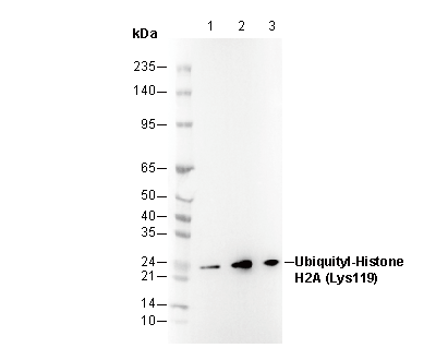 Ubiquityl-Histone H2A (Lys119) Antibody