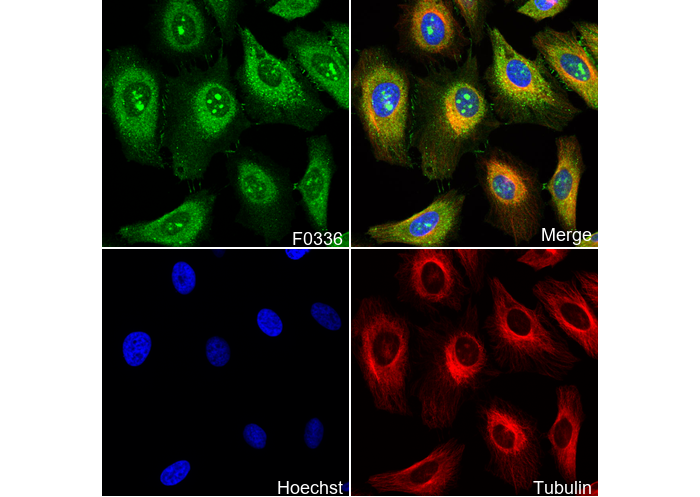 Non-phospho β-Catenin (S33/37/T41) Antibody