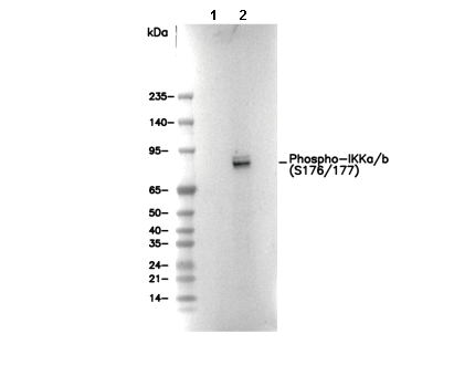 Phospho-IKKα/β (S176/177) Antibody