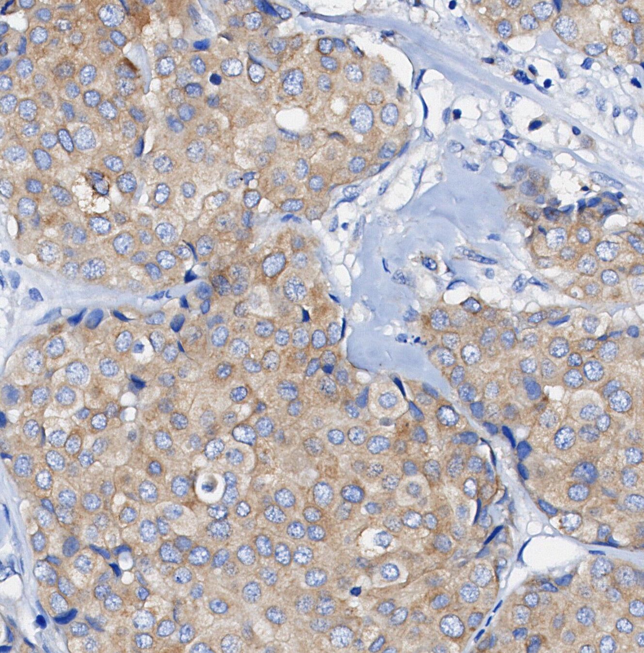 Phospho-NDRG1 (Thr346) Antibody