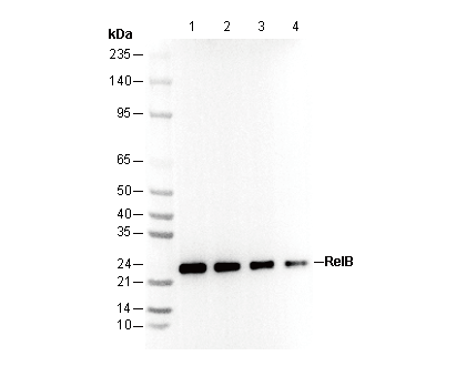 Ubiquityl-Histone H2B (Lys120) Antibody