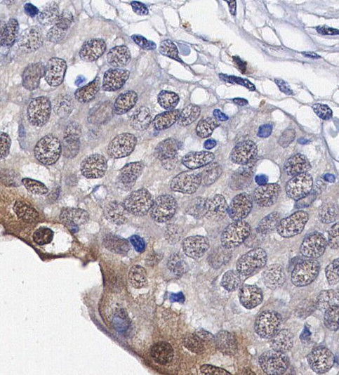 HDAC6 Antibody