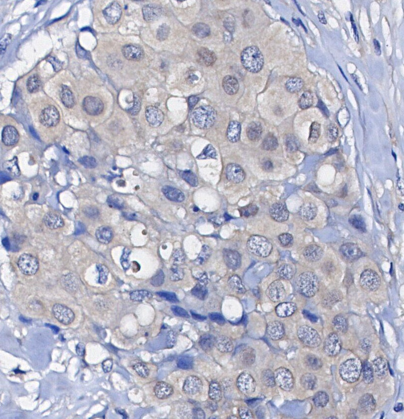 Phospho-p90RSK (Ser380) Antibody
