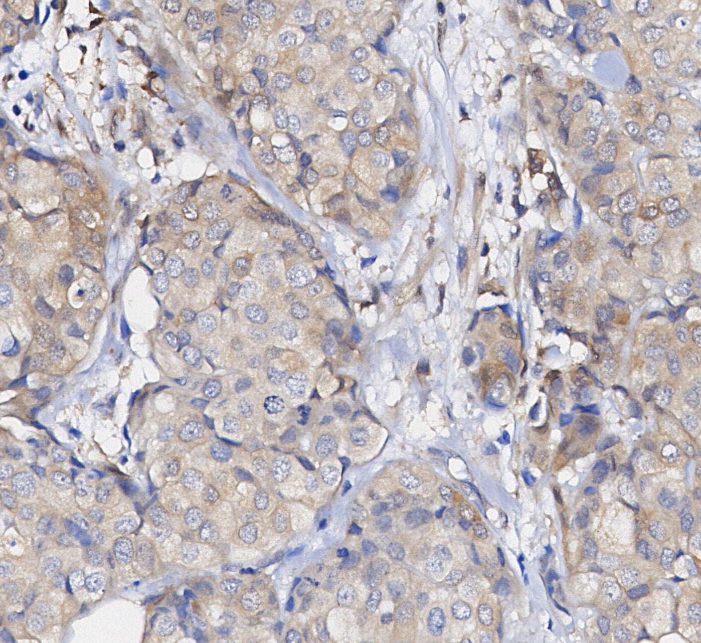 Stat5 Antibody