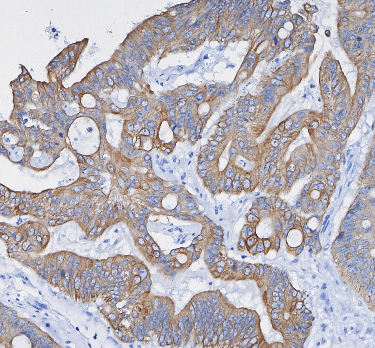 Keratin 8/18 Antibody