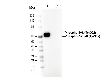 Phospho-Zap-70 (Tyr319)/Syk (Tyr352) Antibody