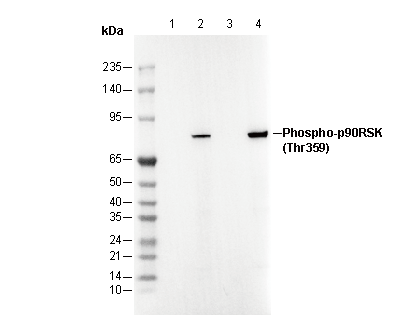 Phospho-p90 RSK (Thr359) Antibody