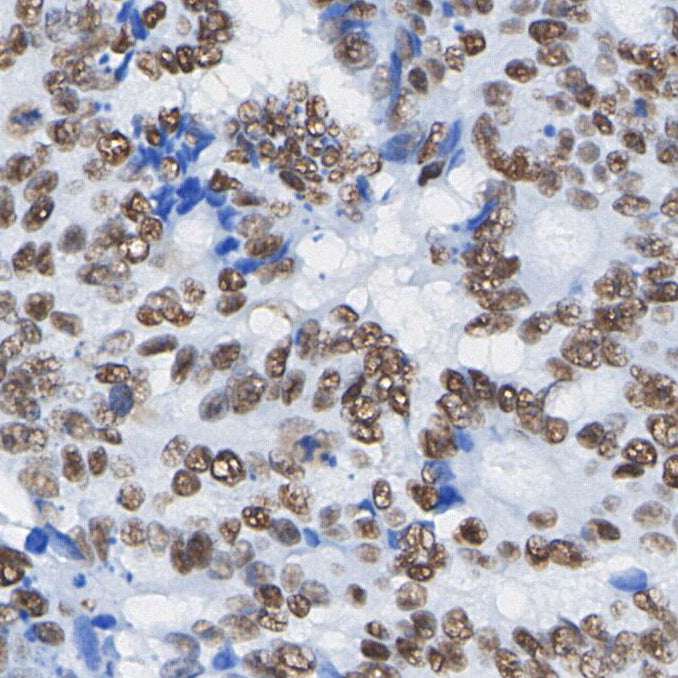 HMGA2 Antibody