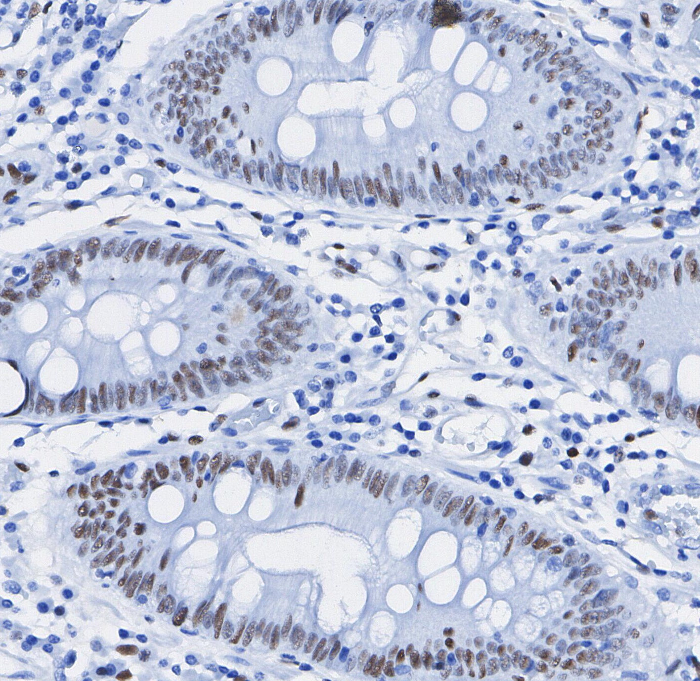 GATA-1 Antibody