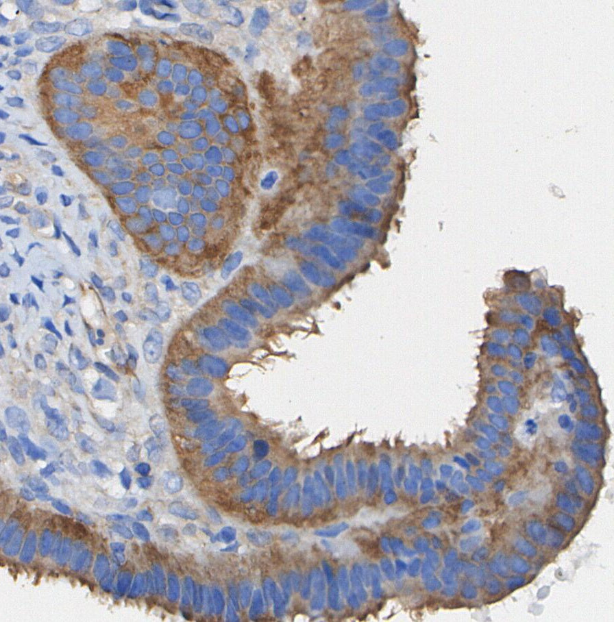 Phospho-HSP27 (Ser82) Antibody