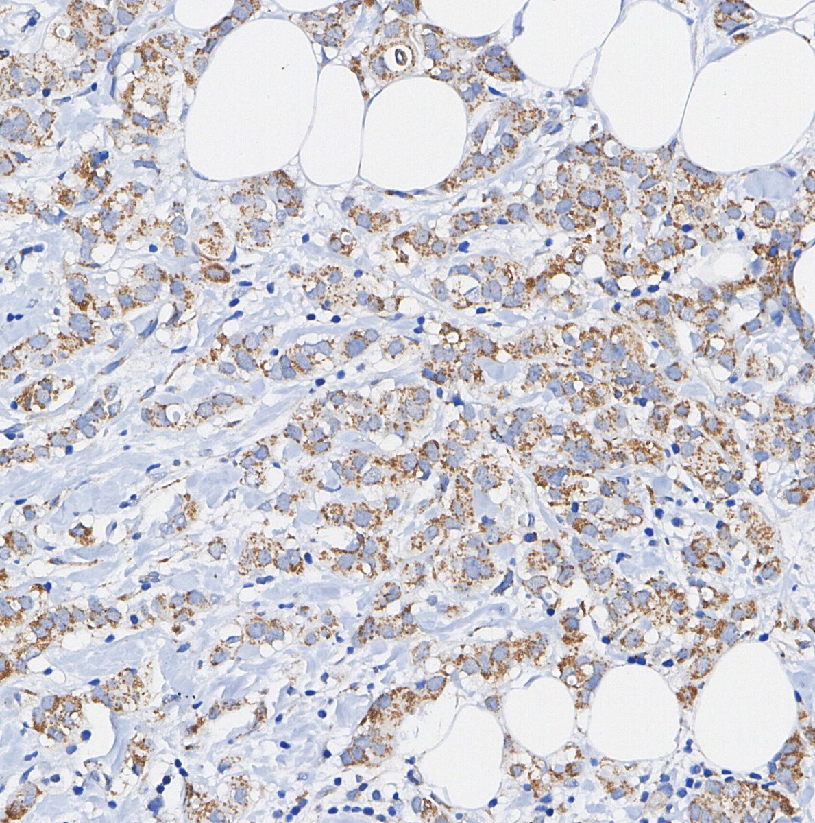 Grp75 Antibody