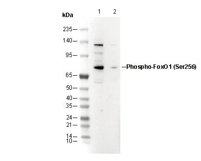 Phospho-FoxO1 (Ser256) Antibody