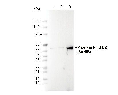 Phospho-PFKFB2 (Ser483) Antibody