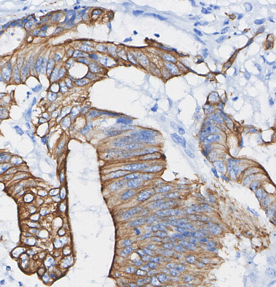 Cytokeratin 19 Antibody