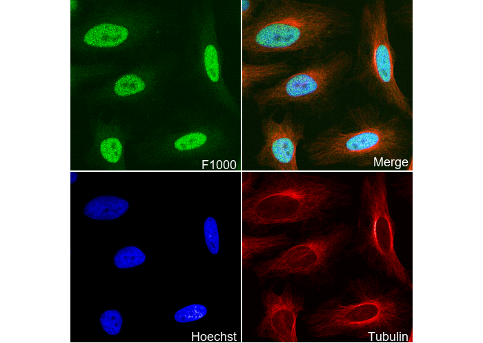 METTL3 Antibody
