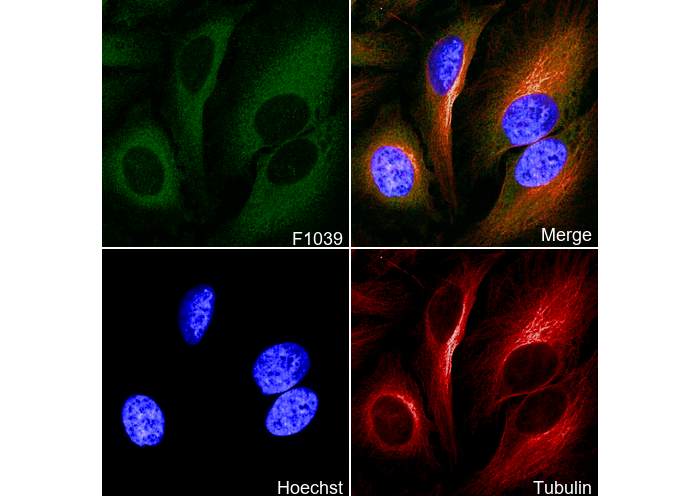 Galectin 1 Antibody