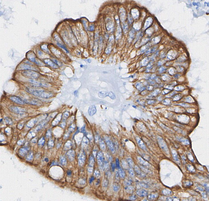 MMP14 Antibody