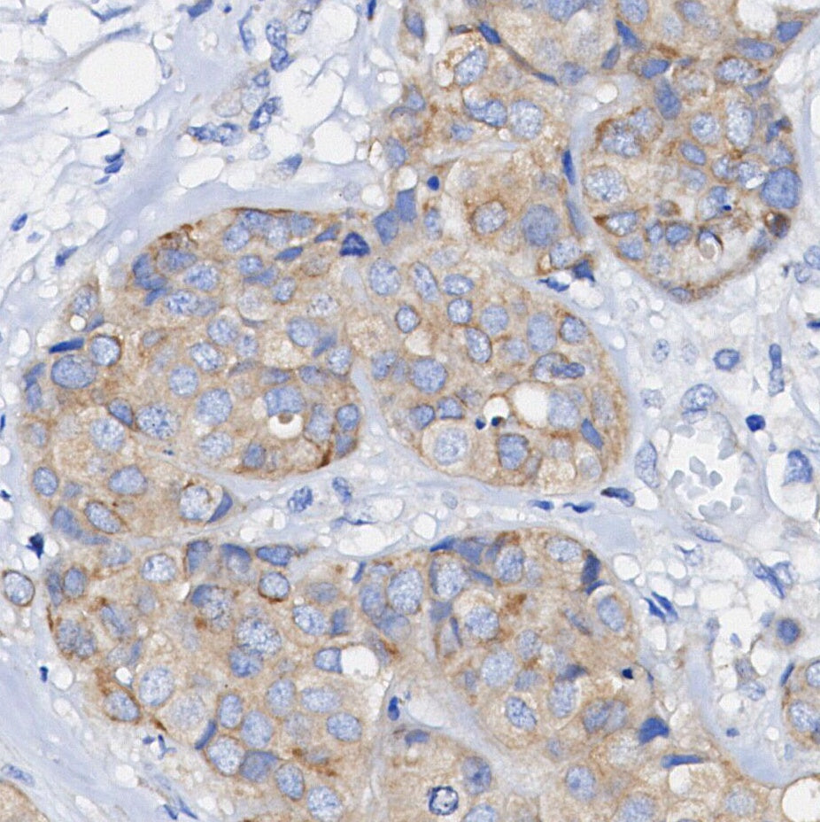 PARK7/DJ1 Antibody
