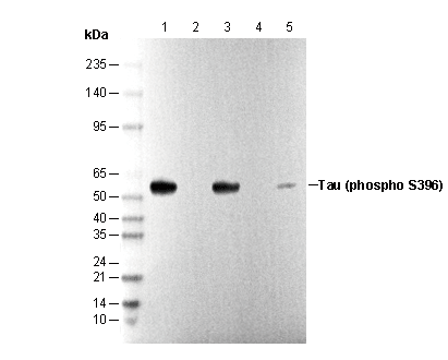 Phospho-Tau (Ser396) Antibody
