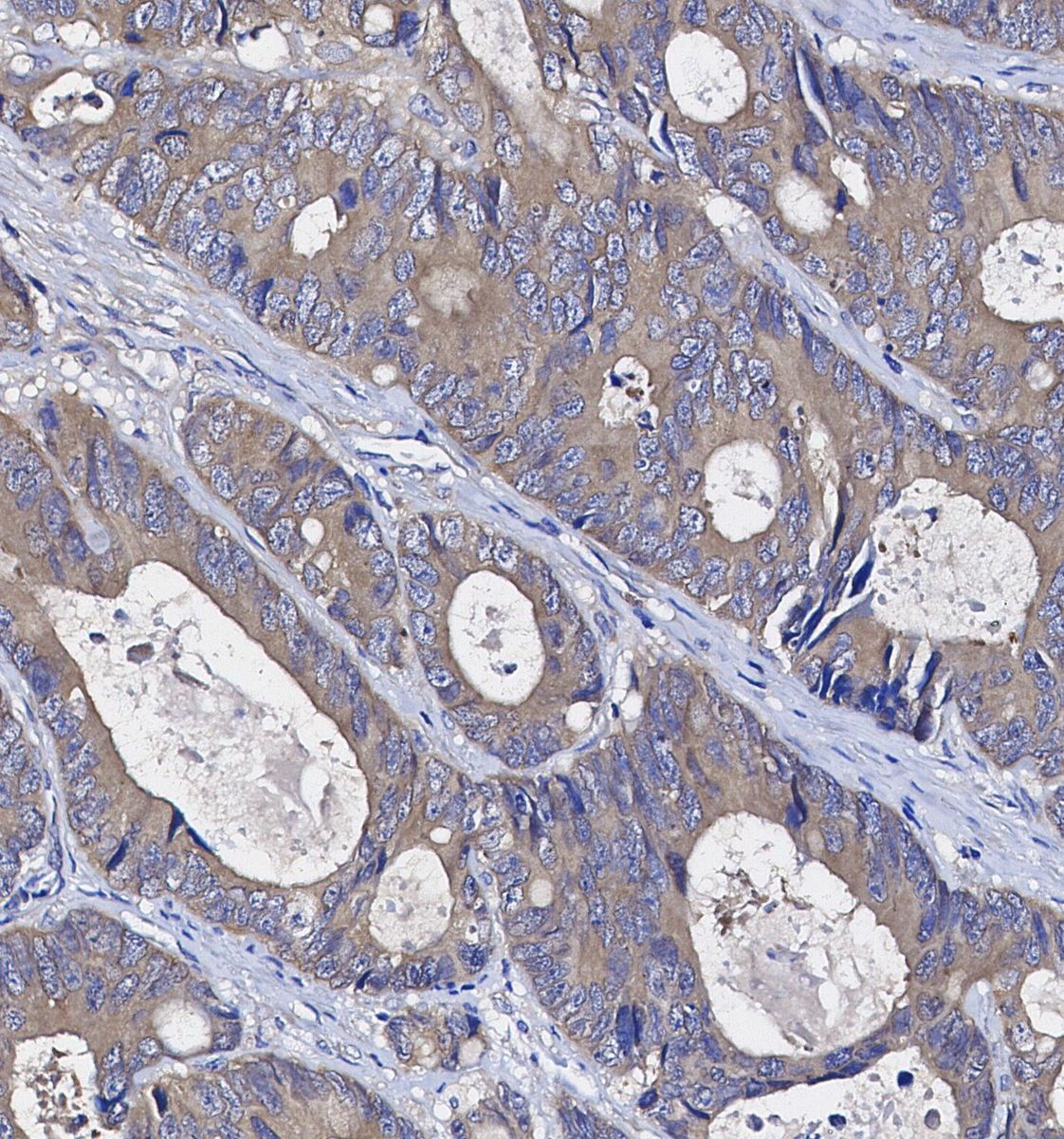 RRM2 Antibody