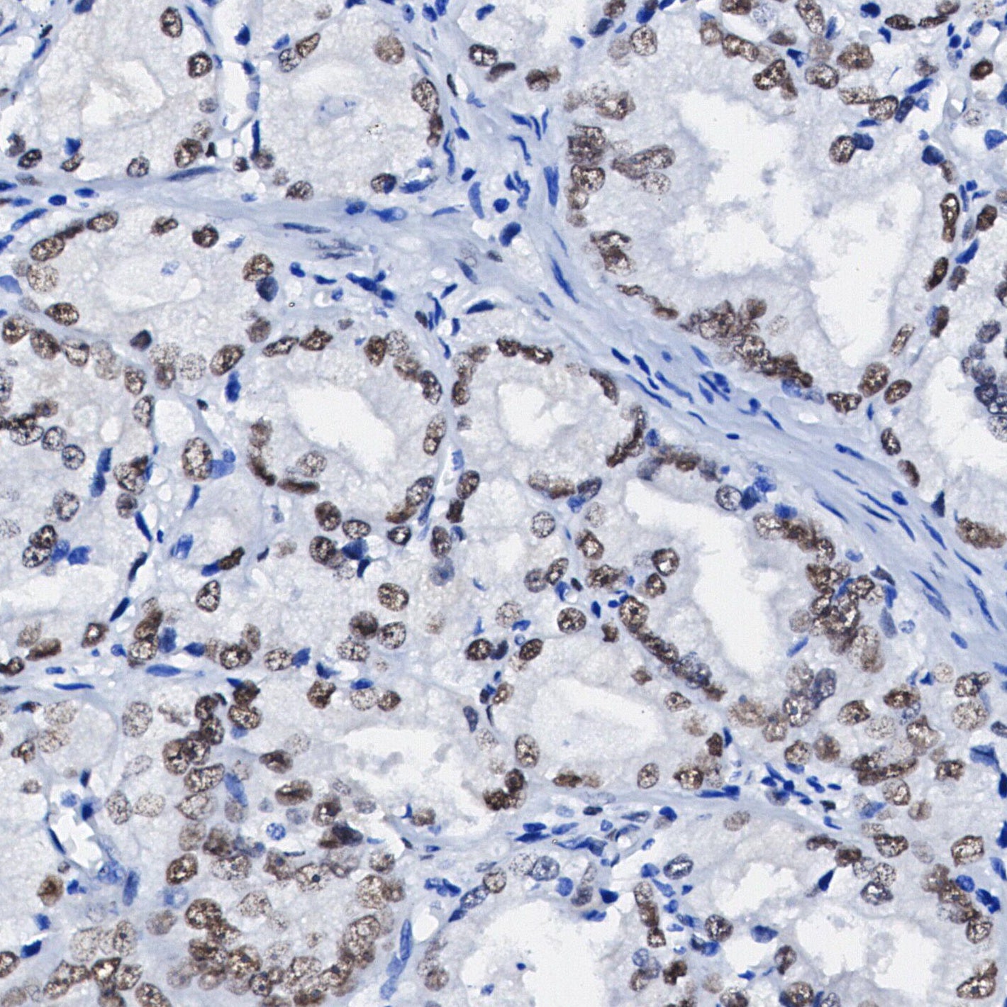 YY1 Antibody
