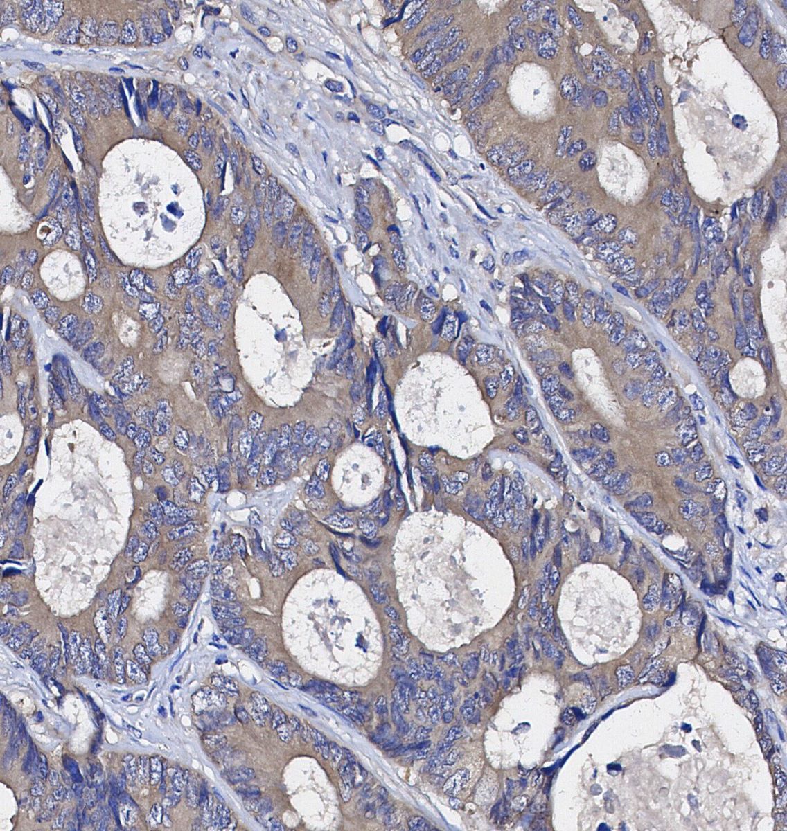CDK5 Antibody