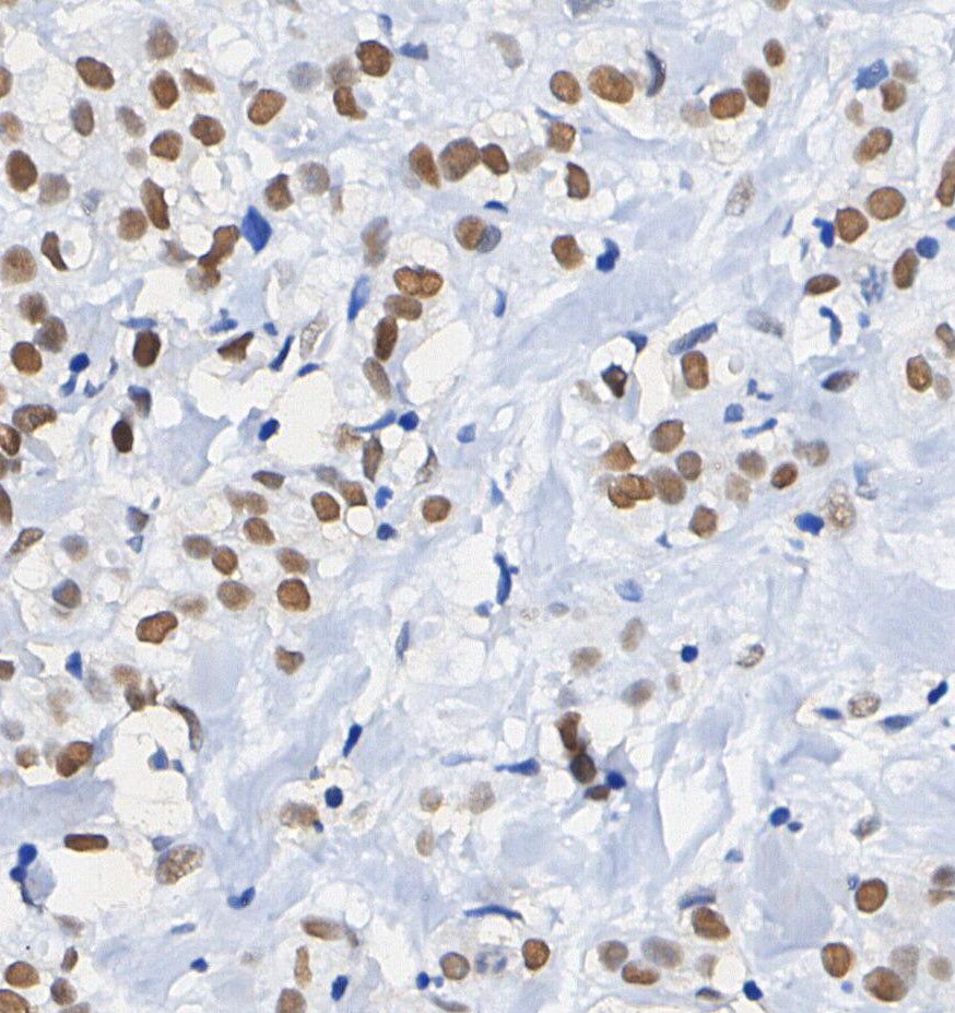 Histone H4 (acetyl Lys16) Antibody