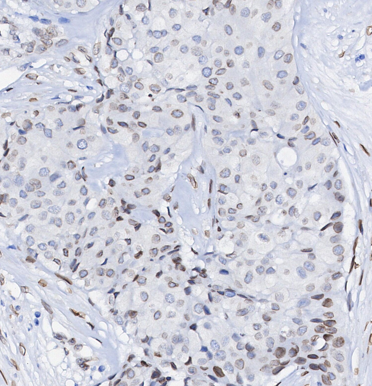 Lamin B2 Antibody
