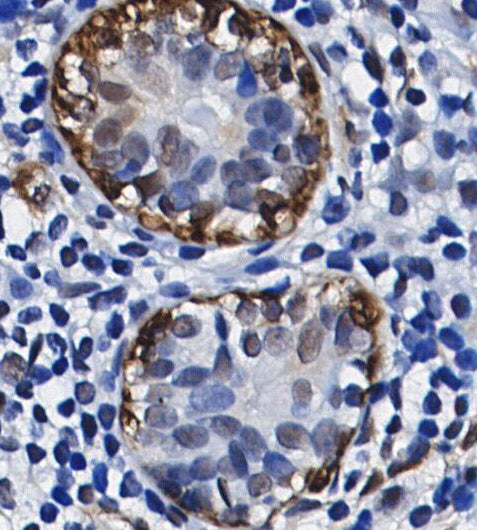 Superoxide Dismutase 1 Antibody