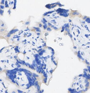 TIMP2 Antibody