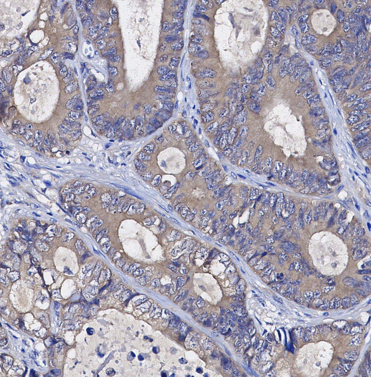 USP9X Antibody