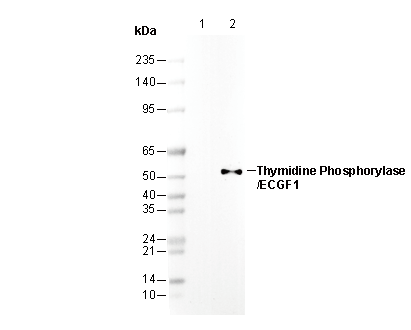 Thymidine Phosphorylase/ECGF1 Antibody