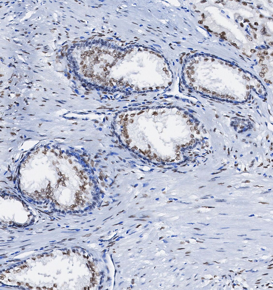 APE Antibody