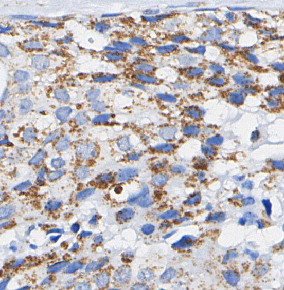 Nuclear Pore Complex Proteins Antibody