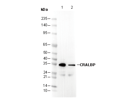 CRALBP Antibody