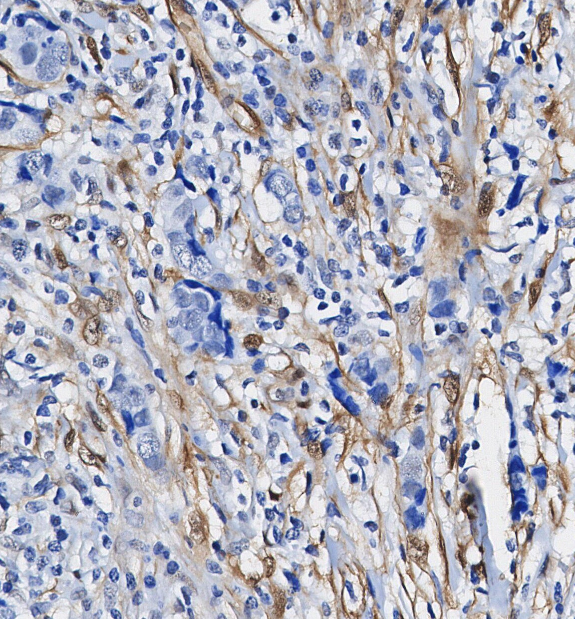 S100 β Antibody