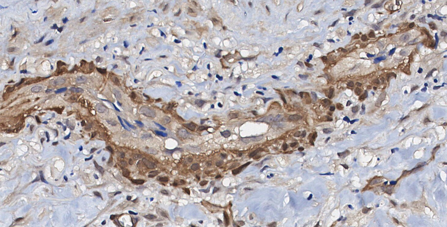 NDUFB8 Antibody