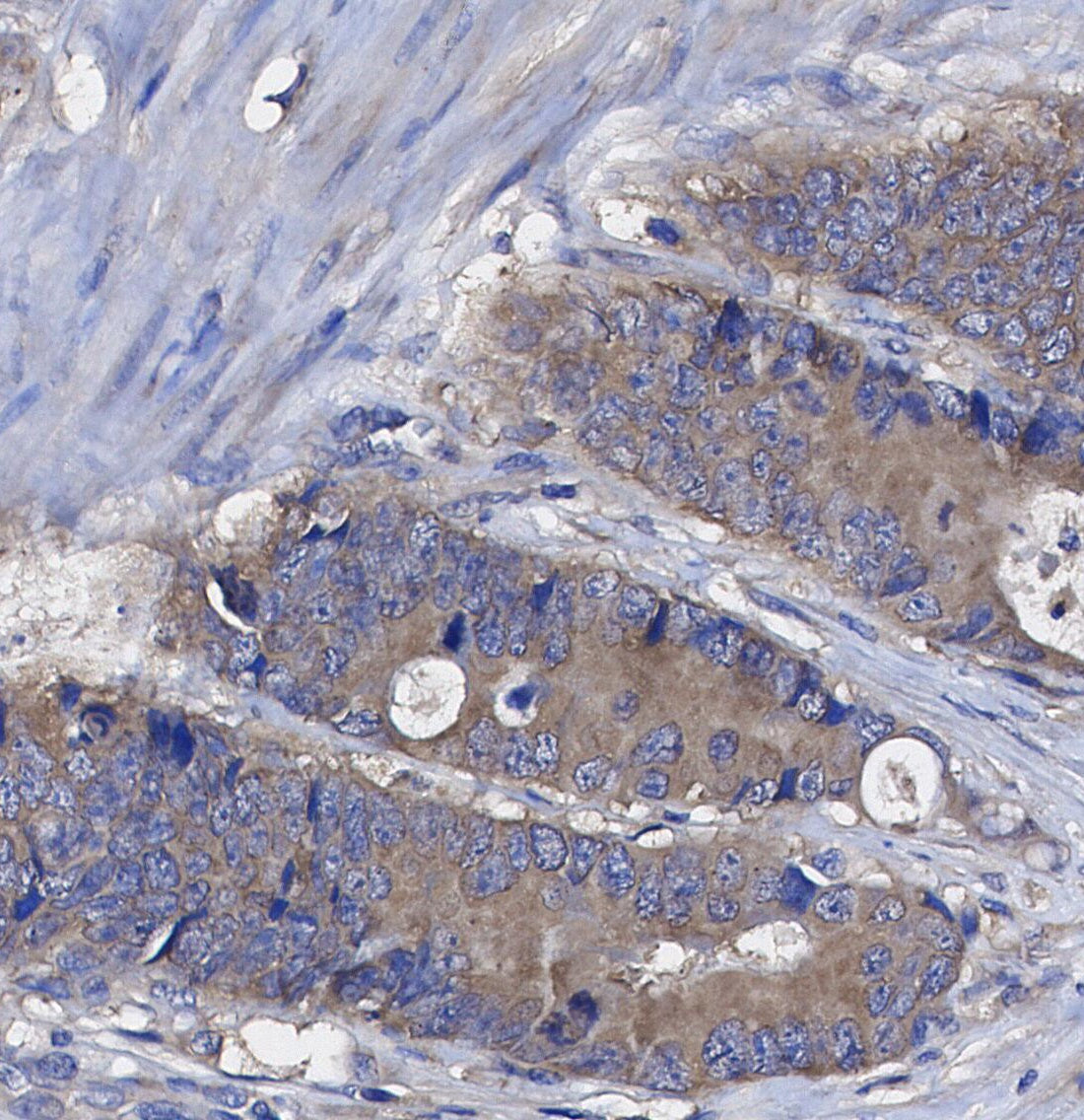 TICAM-1(TRIF) Antibody