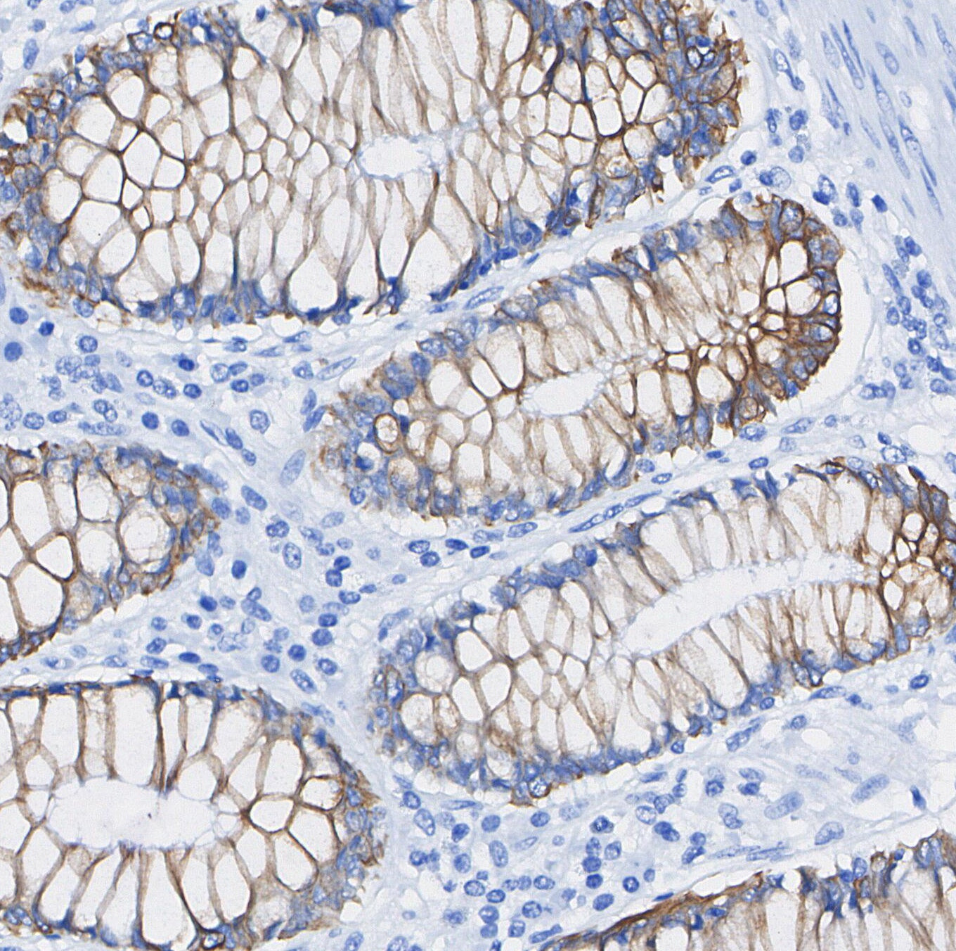 PI 3 Kinase p85 β Antibody