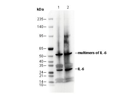 IL-6 Antibody
