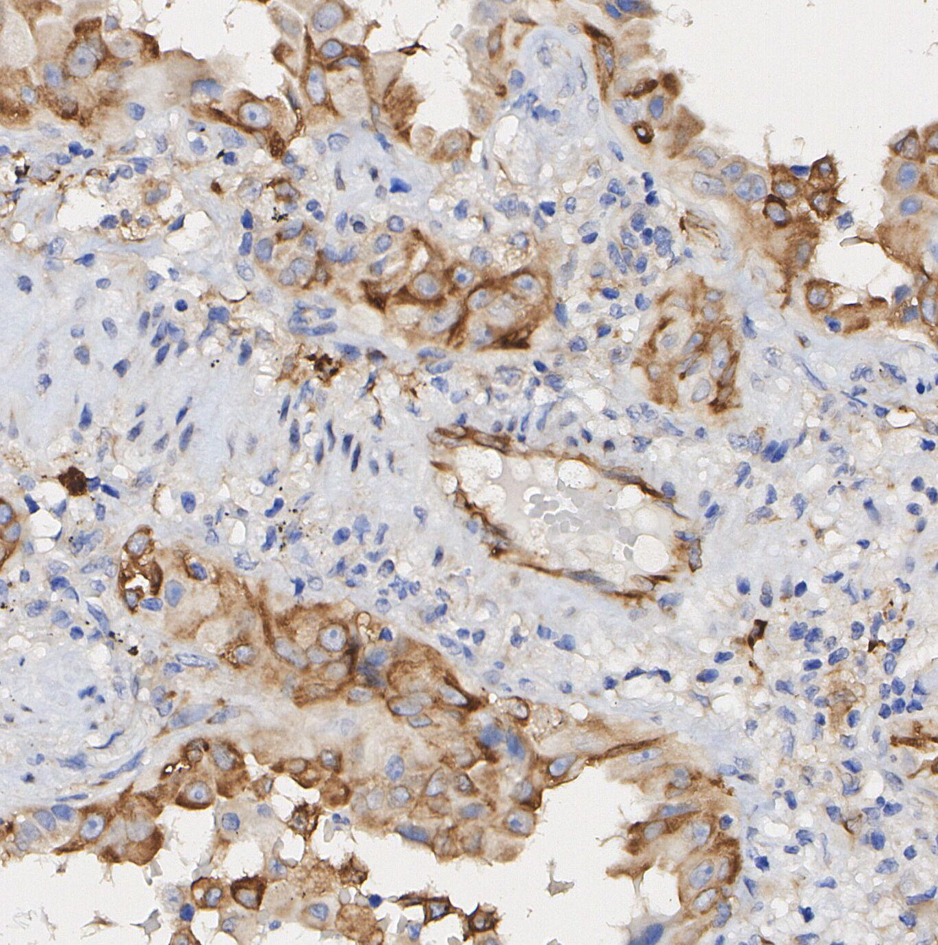 Phospho-PKAR2/PKR2 (Ser99) Antibody