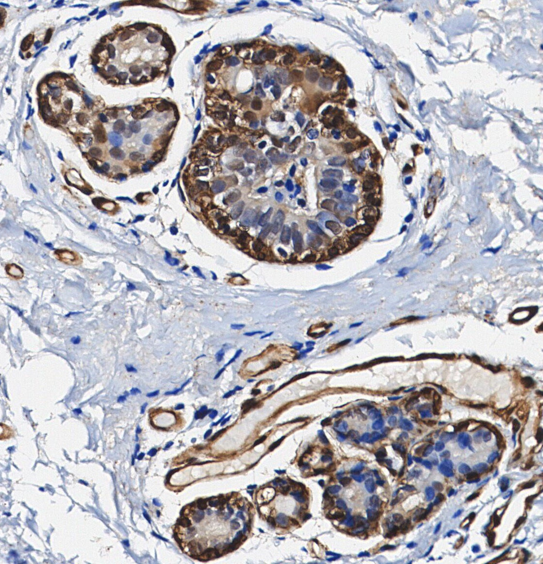 Choline Acetyltransferase Antibody