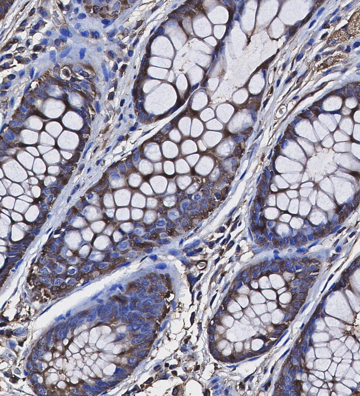 LOX Antibody