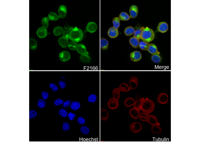 Niemann Pick C1 Antibody