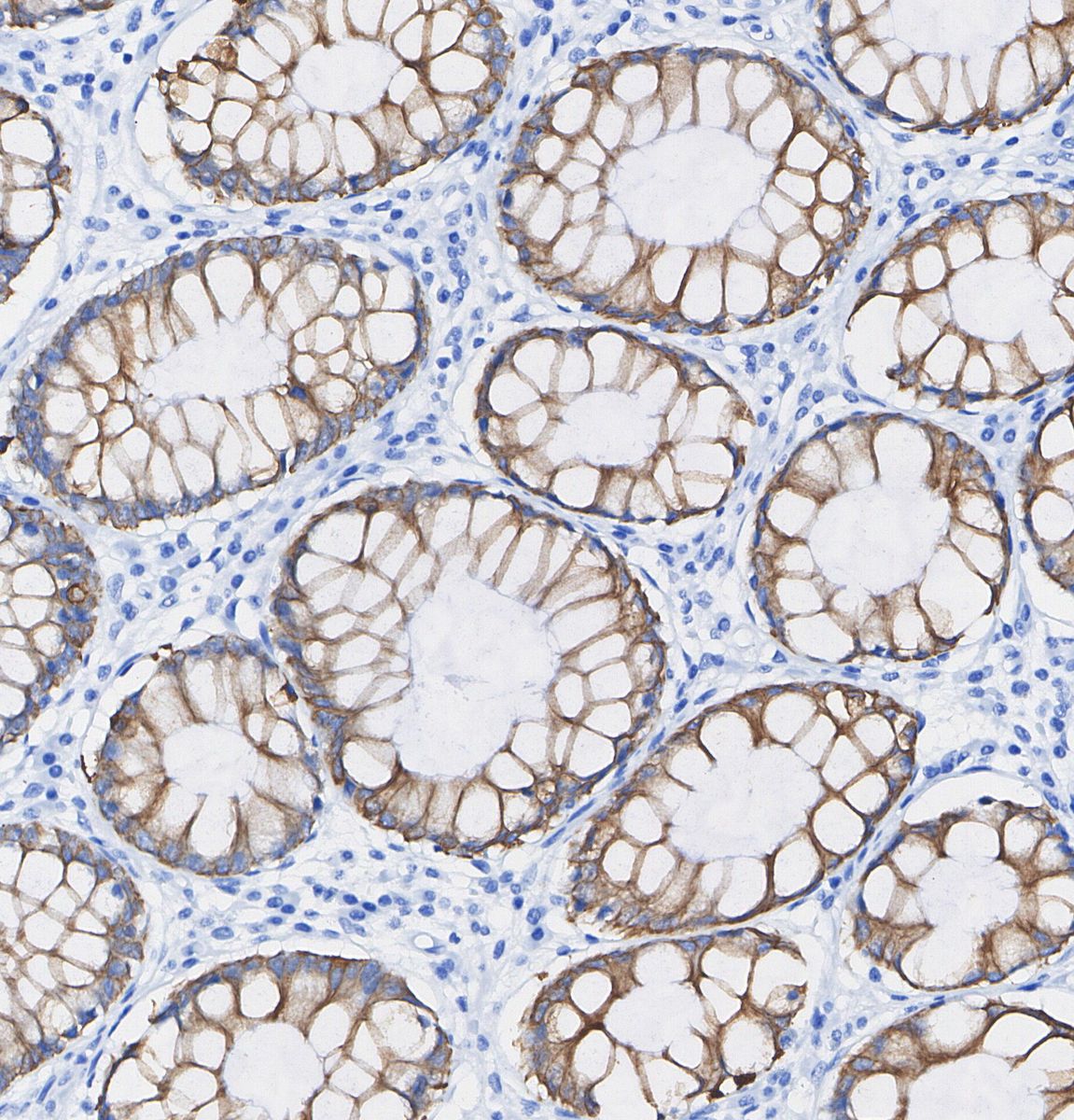 Cytokeratin 13 Antibody